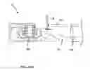 Fig. 48 - MULTI-ACTUATING TRIGGER ANCHOR DELIVERY SYSTEM