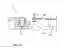 Fig. 49 - MULTI-ACTUATING TRIGGER ANCHOR DELIVERY SYSTEM