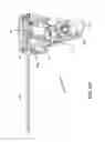 Fig. 50 - MULTI-ACTUATING TRIGGER ANCHOR DELIVERY SYSTEM