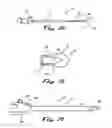 Fig. 02 - APPARATUS AND METHODS FOR PERFORMING MINIMALLY-INVASIVE SURGICAL PROCEDURES