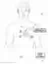 Fig. 02 - SYSTEMS AND METHODS FOR DETERMINING OPTIMAL INTERVENTRICULAR PACING DELAYS BASED ON ELECTROMECHANICAL DELAYS