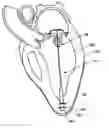 Fig. 01 - Adjustable heart valve implant