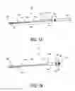 Fig. 02 - Adjustable heart valve implant