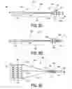 Fig. 06 - Adjustable heart valve implant