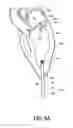 Fig. 08 - Adjustable heart valve implant