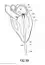 Fig. 09 - Adjustable heart valve implant