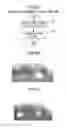 Fig. 14 - IMAGING UNIT, ATTACHED MATTER DETECTOR, CONTROL SYSTEM FOR VEHICLE, AND VEHICLE