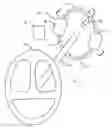 Fig. 01 - Rollover prevention apparatus