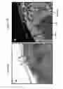 Fig. 11 - Method for analyzing biological specimens by spectral imaging