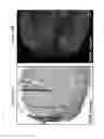 Fig. 15 - Method for analyzing biological specimens by spectral imaging