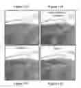 Fig. 22 - Method for analyzing biological specimens by spectral imaging