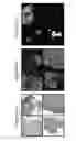 Fig. 29 - Method for analyzing biological specimens by spectral imaging