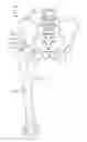 Fig. 01 - PROSTHETIC PLACEMENT TOOL AND ASSOCIATED METHODS