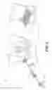 Fig. 04 - PROSTHETIC PLACEMENT TOOL AND ASSOCIATED METHODS