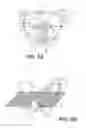 Fig. 06 - PROSTHETIC PLACEMENT TOOL AND ASSOCIATED METHODS