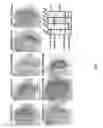 Fig. 06 - Methods And Compositions Comprising A Drosophila Model Of Amyotrophic Lateral Sclerosis