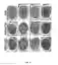 Fig. 14 - Methods And Compositions Comprising A Drosophila Model Of Amyotrophic Lateral Sclerosis