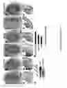 Fig. 18 - Methods And Compositions Comprising A Drosophila Model Of Amyotrophic Lateral Sclerosis