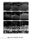 Fig. 19 - Methods And Compositions Comprising A Drosophila Model Of Amyotrophic Lateral Sclerosis