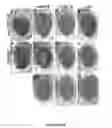 Fig. 24 - Methods And Compositions Comprising A Drosophila Model Of Amyotrophic Lateral Sclerosis