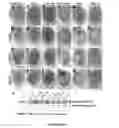 Fig. 25 - Methods And Compositions Comprising A Drosophila Model Of Amyotrophic Lateral Sclerosis