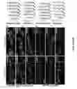 Fig. 30 - Methods And Compositions Comprising A Drosophila Model Of Amyotrophic Lateral Sclerosis