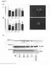 Fig. 18 - Transgenic non-human animal comprising a mutant alpha-synuclein