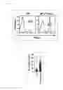 Fig. 37 - COMPOSITION FOR INDUCING PROLIFERATION OR ACCUMULATION OF REGULATORY T CELLS
