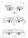 Fig. 02 - Method and apparatus for diverting sweat, liquid, moisture, or the like from an eye