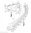 Fig. 06 - Article of footwear with a stretchable upper and an articulated sole structure