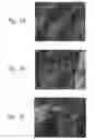 Fig. 04 - SEMICONDUCTOR PROCESSING APPARATUS WITH A CERAMIC-COMPRISING SURFACE WHICH EXHIBITS FRACTURE TOUGHNESS AND HALOGEN PLASMA RESISTANCE