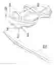 Fig. 01 - Temporary Footwear Modification Device