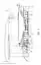 Fig. 06 - Geared turbofan engine gearbox arrangement