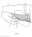 Fig. 04 - Pick-rite guitar aid