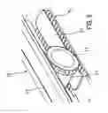Fig. 06 - DEVICE FOR A VACUUM AND FOR TRANSMITTING OR ENABLING A MOVEMENT