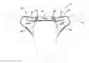 Fig. 01 - Horn wrap