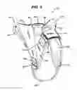 Fig. 04 - Horn wrap