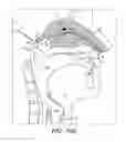 Fig. 02 - Nasal administration