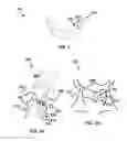 Fig. 02 - Device and method for correcting obstructive sleep apnea