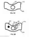 Fig. 03 - Device and method for correcting obstructive sleep apnea