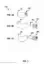 Fig. 05 - Device and method for correcting obstructive sleep apnea