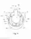 Fig. 10 - Dispensing apparatus and dispensing method