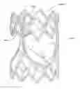 Fig. 01 - Methods of making a prosthetic valve with a durable high strength polymer composite leaflet