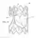 Fig. 12 - Methods of making a prosthetic valve with a durable high strength polymer composite leaflet