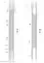 Fig. 08 - Downhole force generating tool