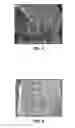 Fig. 06 - Polycrystalline compacts, earth-boring tools including such compacts, and methods of fabricating polycrystalline compacts