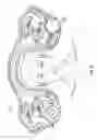 Fig. 02 - Ophthalmic surgical systems, methods, and devices