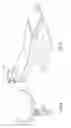 Fig. 03 - Ophthalmic surgical systems, methods, and devices