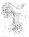 Fig. 12 - Ophthalmic surgical systems, methods, and devices