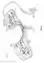 Fig. 20 - Ophthalmic surgical systems, methods, and devices